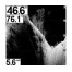 Humminbird 571x HD DI